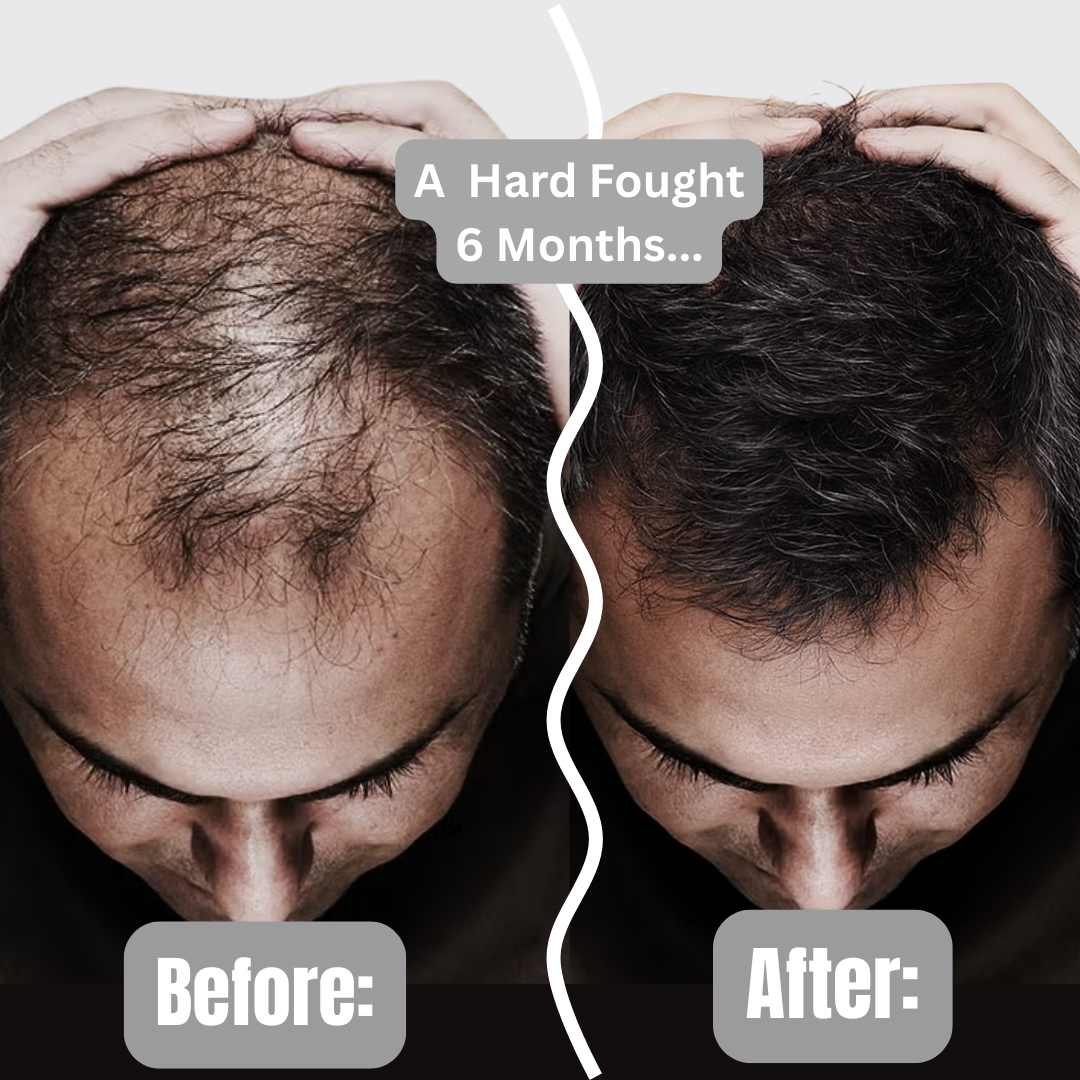 Ferny's Rosemary and Mint Hair Oil