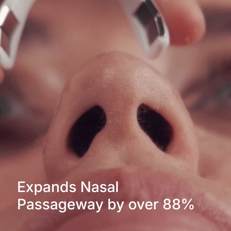 The NightBridge - Magnetic Nasal Dilator