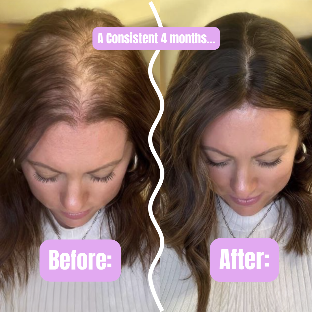 Ferny's Rosemary and Mint Hair Oil